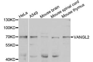 Western blot analysis of extracts of various cell lines, using VANGL2 antibody. (VANGL2 anticorps)