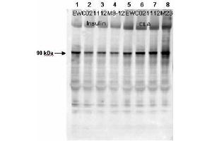 Affinity Purified Phospho-specific antibody to human muscle Glycogen Synthase (GS) at pS640 was used at a 1:1000 dilution to detect human muscle GS by Western blot. (Glycogen Synthase 1 anticorps  (pSer640))