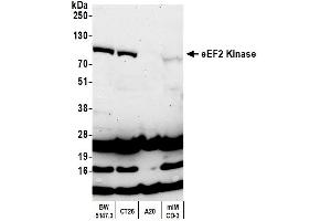 Western Blotting (WB) image for anti-Eukaryotic Elongation Factor-2 Kinase (EEF2K) (AA 675-725) antibody (ABIN7454537) (EEF2K anticorps  (AA 675-725))