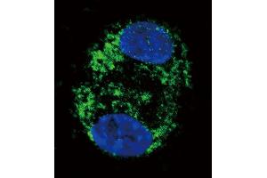 Confocal immunofluorescent analysis of CPT2 Antibody with HepG2 cell followed by Alexa Fluor 488-conjugated goat anti-rabbit lgG (green). (CPT2 anticorps  (C-Term))