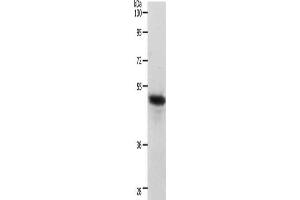 Gel: 10 % SDS-PAGE, Lysate: 40 μg, Lane: Human liver cancer tissue, Primary antibody: ABIN7190220(CERS2 Antibody) at dilution 1/750, Secondary antibody: Goat anti rabbit IgG at 1/8000 dilution, Exposure time: 40 seconds (Ceramide Synthase 2 anticorps)
