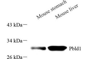 Western blot analysis of PBLD (ABIN7075030),at dilution of 1: 2000 (PBLD1 anticorps)