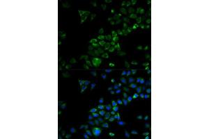 Immunofluorescence analysis of HeLa cells using TRAF3 antibody. (TRAF3 anticorps)