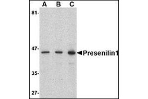 Western blot analysis of presenilin1 in human brain lysate with this product at (A) 0.