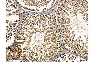 ABIN7096468 and ABIN7100532 at 1/100 staining rat testis tissue by IHC-P.