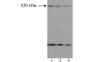 Western Blotting (WB) image for anti-Nuclear Factor of Activated T-Cells, Cytoplasmic, Calcineurin-Dependent 2 (NFAT1) (AA 433-567) antibody (ABIN967558) (NFAT1 anticorps  (AA 433-567))