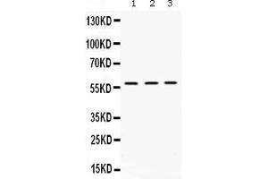 Western blot analysis of XIAP expression in rat kidney extract ( Lane 1), mouse liver extract ( Lane 2) and HELA whole cell lysates ( Lane 3). (XIAP anticorps  (AA 15-244))