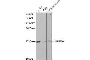Western blot analysis of extracts of various cell lines, using SH2D1A antibody (ABIN3021535, ABIN3021536, ABIN3021537 and ABIN6215210) at 1:1000 dilution.