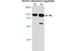 Western blot analysis of in extracts from MOLT 4 cell using RB1 (phospho S807) monoclonal antibody, clone 5H12 . (Retinoblastoma 1 anticorps  (pSer807))
