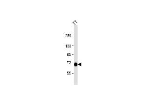 Anti-PCSK2 Antibody (N-term) at 1:1000 dilution + TT whole cell lysate Lysates/proteins at 20 μg per lane.