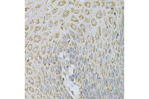 Immunohistochemistry of paraffin-embedded human esophagus using AP2B1 Antibody.