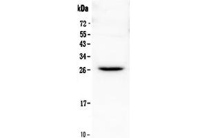 Western blot analysis of Flt3 ligand using anti-Flt3 ligand antibody . (FLT3LG anticorps  (AA 28-189))