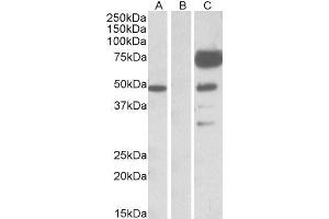 HEK293 lysate (10ug protein in RIPA buffer) overexpressing Human ANGPT1 with DYKDDDDK tag probed with ABIN2561113 (1ug/ml) in Lane A and probed with anti- DYKDDDDK Tag (1/1000) in lane C. (Angiopoietin 1 anticorps  (Internal Region))
