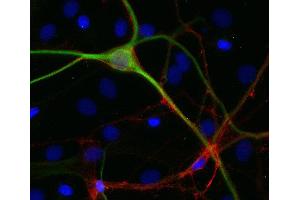 Indirect immmunostaining of PFA fixed rat hippocampus neurons with anti-GAP 43 (dilution: 1 : 500; red) and mouse anti-MAP 2 (, dilution 1 : 500; green).