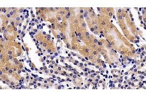 Detection of TNFR1 in Mouse Kidney Tissue using Polyclonal Antibody to Tumor Necrosis Factor Receptor 1 (TNFR1)