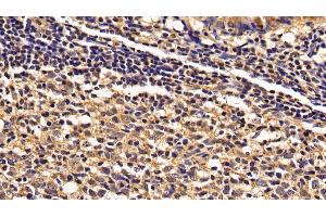 Detection of IL2Rg in Human Appendix Tissue using Polyclonal Antibody to Interleukin 2 Receptor Gamma (IL2Rg)