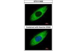 Image no. 4 for anti-Ribosomal Protein S3A (RPS3A) (AA 1-264) antibody (ABIN1501993) (RPS3A anticorps  (AA 1-264))