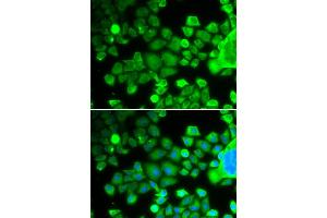 Immunofluorescence analysis of MCF-7 cells using RPS10 antibody (ABIN1877083). (RPS10 anticorps)