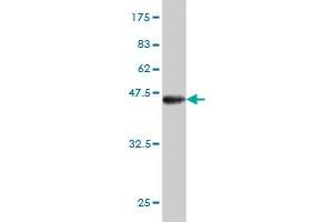 Western Blot detection against Immunogen (40. (BRD3 anticorps  (AA 418-556))
