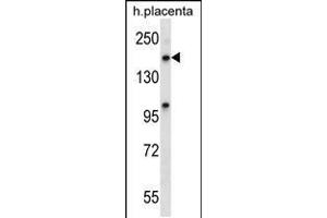 Western blot analysis in human placenta tissue lysates (35ug/lane). (XPO5 anticorps  (C-Term))