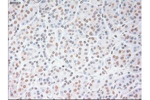 Immunohistochemical staining of paraffin-embedded lung tissue using anti-USP13mouse monoclonal antibody. (USP13 anticorps)
