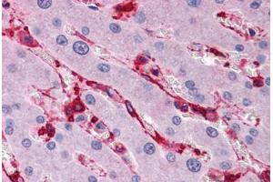 Human Liver: Formalin-Fixed, Paraffin-Embedded (FFPE)