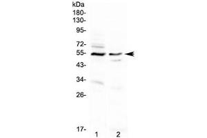 Western blot testing of human 1) A431 and 2) PANC-1 cell lysate with VIPR1 antibody. (VIPR1 anticorps)