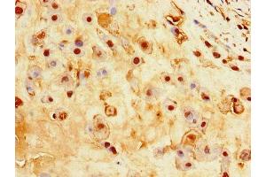 Immunohistochemistry of paraffin-embedded human placenta tissue using ABIN7156880 at dilution of 1:100 (EBI3 anticorps  (AA 21-227))
