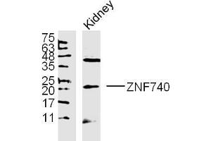 ZNF740 lysates probed with Polyclonal Antibody, unconjugated  at 1:300 overnight at 4°C followed by a conjugated secondary antibody at 1:10000 for 90 minutes at 37°C. (ZNF740 anticorps  (AA 101-193))