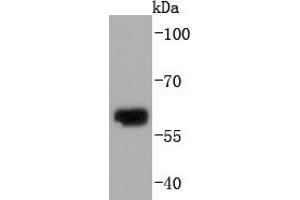 Human skin ysates probed with Collagen X (1H8) Monoclonal Antibody  at 1:1000 overnight at 4˚C. (COL10 anticorps)