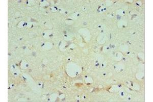 Immunohistochemistry of paraffin-embedded human brain tissue using ABIN7170476 at dilution of 1:100 (SPAG16 anticorps  (AA 1-183))