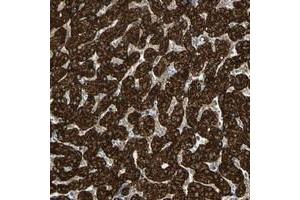 Immunohistochemical staining of human liver with FLII polyclonal antibody  shows strong cytoplasmic positivity in hepatocytes at 1:50-1:200 dilution. (FLII anticorps)