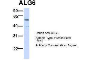 Host:  Rabbit  Target Name:  ALG6  Sample Type:  Human Fetal Heart  Antibody Dilution:  1.