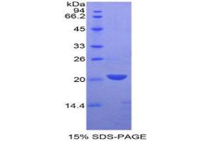 SDS-PAGE (SDS) image for Leukocyte Cell-Derived Chemotaxin 2 (LECT2) (AA 1-151) protein (His tag) (ABIN2125651) (LECT2 Protein (AA 1-151) (His tag))