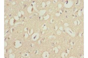 Immunohistochemistry of paraffin-embedded human brain tissue using ABIN7166313 at dilution of 1:100