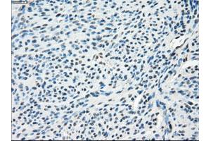 Immunohistochemical staining of paraffin-embedded endometrium tissue using anti-SLC2A5mouse monoclonal antibody. (SLC2A5 anticorps)
