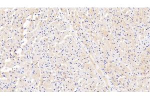 Detection of IRAK4 in Human Cardiac Muscle Tissue using Polyclonal Antibody to Interleukin 1 Receptor Associated Kinase 4 (IRAK4)