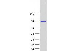 Validation with Western Blot