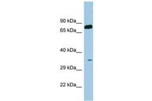 Image no. 1 for anti-serine Dehydratase (SDS) (AA 71-120) antibody (ABIN6741650) (serine Dehydratase anticorps  (AA 71-120))