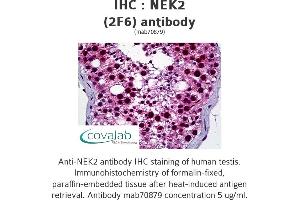 Image no. 1 for anti-NIMA (Never in Mitosis Gene A)-Related Kinase 2 (NEK2) (AA 331-445) antibody (ABIN1723728) (NEK2 anticorps  (AA 331-445))
