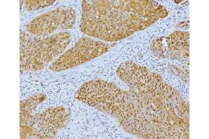 IHC analysis of YY1 using anti-YY1 antibody (ABIN7603000). (YY1 anticorps  (Middle Region))