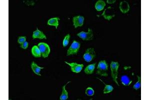 Immunofluorescent analysis of MCF-7 cells using ABIN7157372 at dilution of 1:100 and Alexa Fluor 488-congugated AffiniPure Goat Anti-Rabbit IgG(H+L)