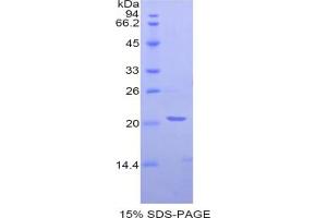 SDS-PAGE analysis of Rat NAGase Protein. (MGEA5 Protéine)