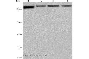 Western blot analysis of PC3, Hela, NIH/3T3 and HUVEB cell, using FLNA Polyclonal Antibody at dilution of 1:800 (Filamin A anticorps)