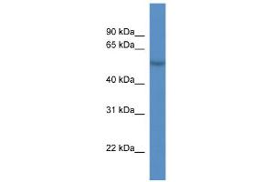 WB Suggested Anti-CDR2L Antibody Titration:  0. (CDR2L anticorps  (C-Term))
