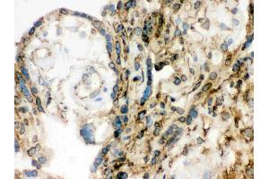 IHC analysis of Lamin B1 using anti-Lamin B1 antibody .