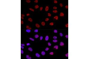 Confocal immunofluorescence analysis of U2OS cells using BC Polyclonal Antibody (ABIN6127480, ABIN6137479, ABIN6137480 and ABIN6220613) at dilution of 1:100. (BCAS2 anticorps  (AA 1-225))