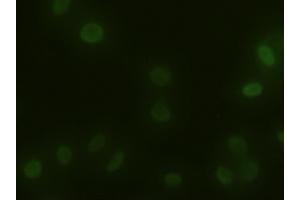 Immunofluorescent staining of HeLa cells using anti-ACTN1 mouse monoclonal antibody (ABIN2452359). (ACTN1 anticorps  (AA 650-893))