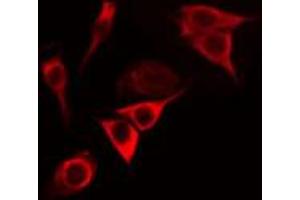 ABIN6272607 staining A549 cells by IF/ICC.