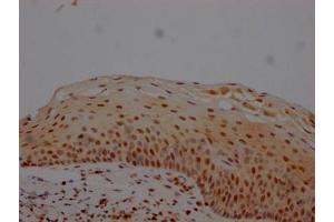 IHC image of ABIN7127619 diluted at 1:100 and staining in paraffin-embedded human tonsil tissue performed on a Leica BondTM system.